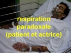 Respiration paradoxale